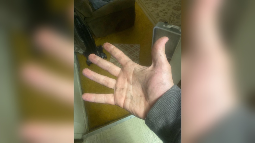 How to Clean JB Weld off Hands Without Skin Damage 55 How to Clean Jb Weld off Hands